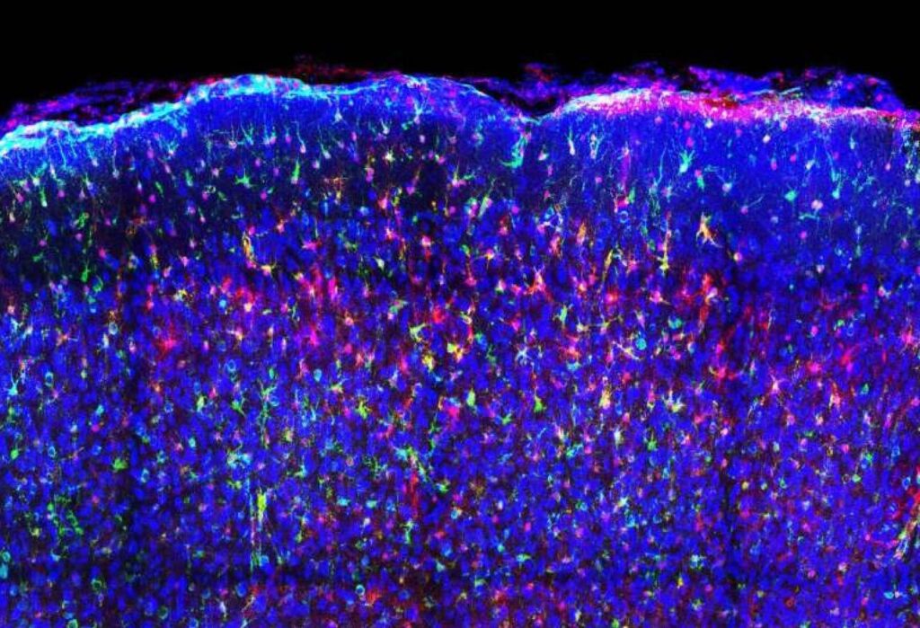 A New Software To Peek Interior The Cell