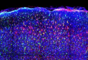 A New Software To Peek Interior The Cell