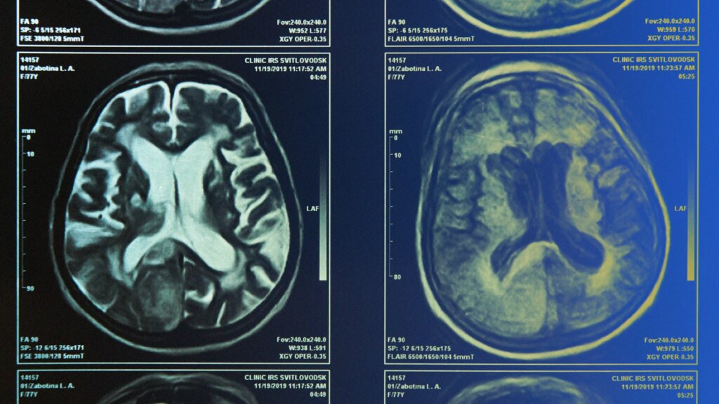 Desire to Abolish Better Choices? A New Explore Reveals How Your Brain Chooses Which Signals Topic