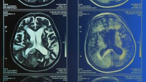 Desire to Abolish Better Choices? A New Explore Reveals How Your Brain Chooses Which Signals Topic