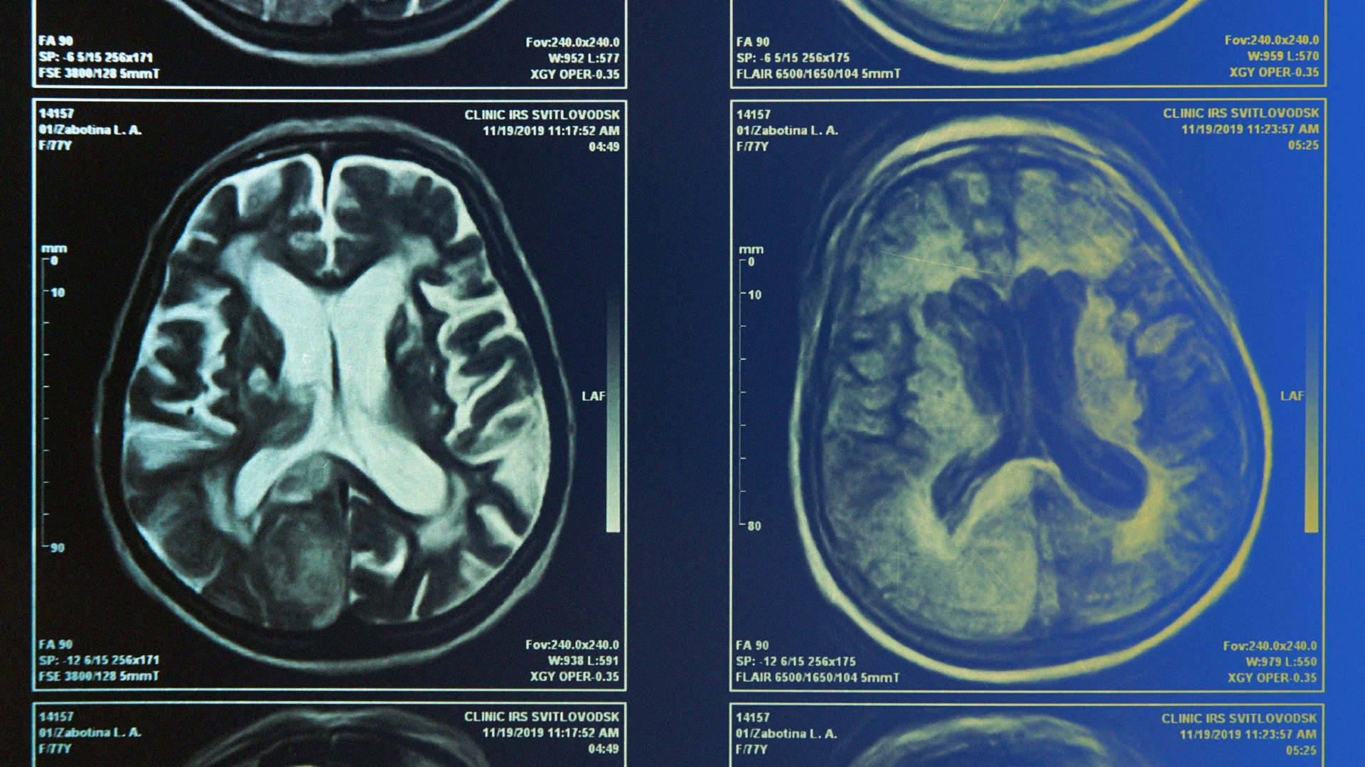 Desire to Abolish Better Choices? A New Explore Reveals How Your Brain Chooses Which Signals Topic